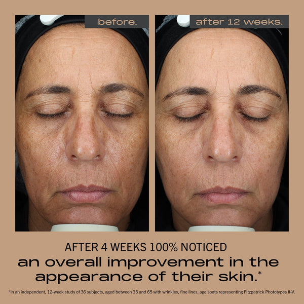 MATTER OF FACT MAXIMALIST AGE-DEFYING MOISTURIZER before and after image